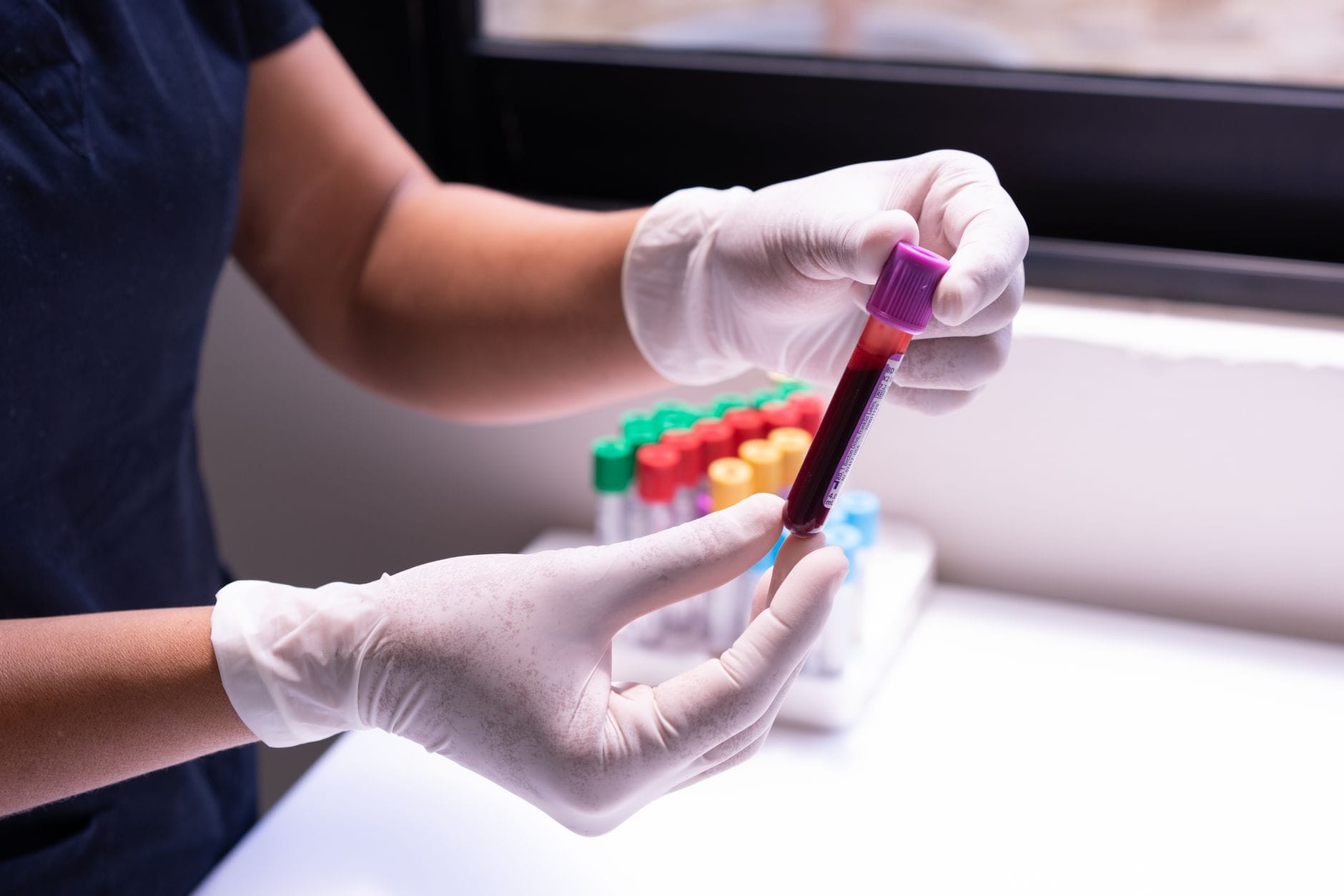 Ręce w rękawiczkach trzymają próbkę krwi w laboratorium medycznym